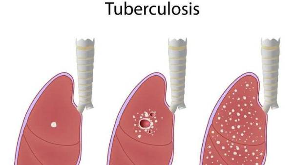 என்ன காரணம்