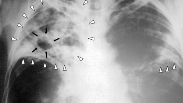 முதல்முறை