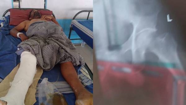 மருத்துவர்கள் சிகிச்சை 