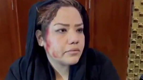 பெண் மீது கொடூர தாக்குதல் பெண் மீது கொடூர தாக்குதல்