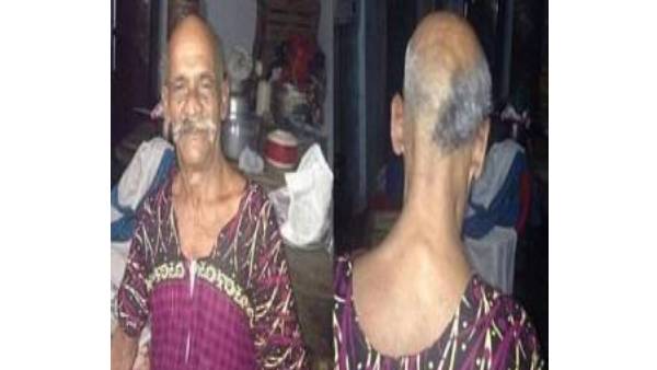 அதிர்ச்சி