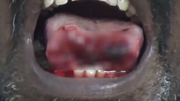 பேசுவதில் பிரச்சனை இல்லை 