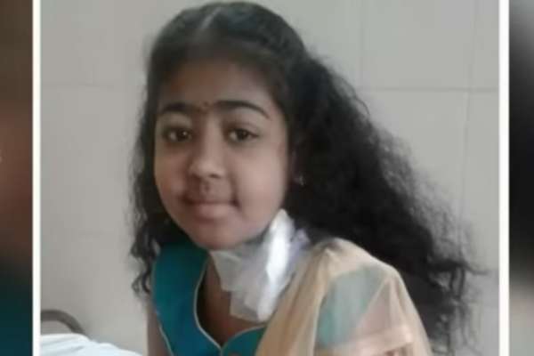  சிகிச்சை 