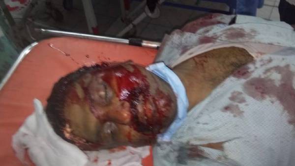 யார் யார் காயம் 