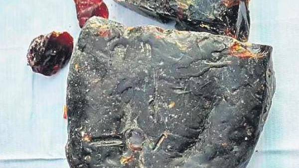 விசாரணை 