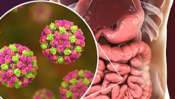 நோரோ வைரஸ் தடுப்பு நடவடிக்கை நோரோ வைரஸ் தடுப்பு நடவடிக்கை