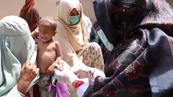 1.40 crore Children starvation, malnutrition: 10 lakh children on the verge of death: UNICEF worry 1.40 crore Children starvation, malnutrition: 10 lakh children on the verge of death: UNICEF worry