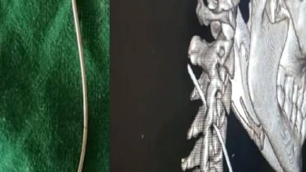 உயிருக்கே ஆபத்து