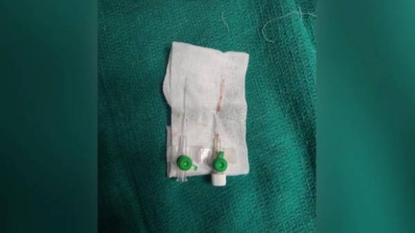 ஊசி இருப்பதை கண்டு அதிர்ச்சி