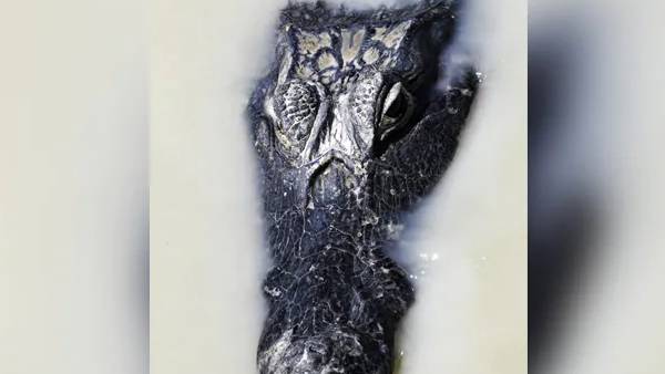  காயங்கள்