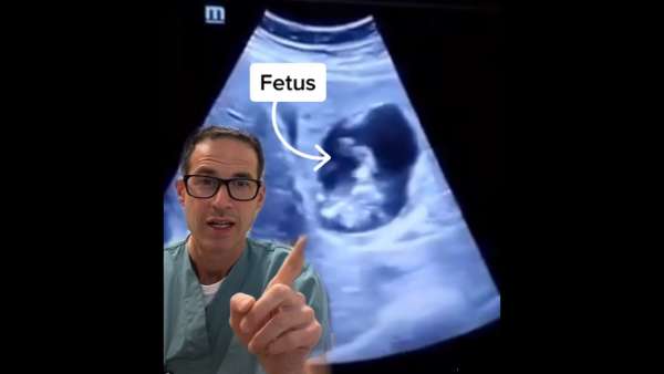 விந்தணு, கருமுட்டை 