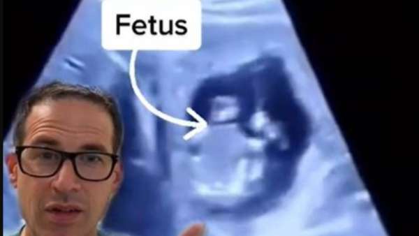 கனடா பெண் 