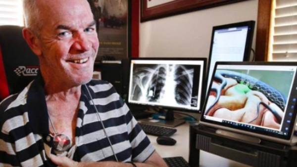 மைக்ரோசிப் 