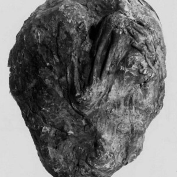 82 வயதில் இறப்பு 82 வயதில் இறப்பு