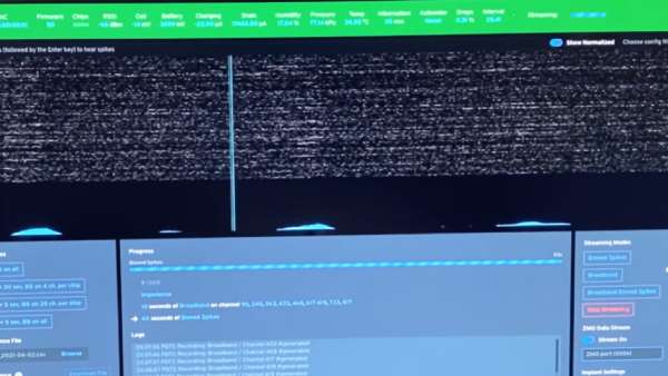 சிப்கள் 