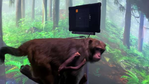 மனித மூளை 