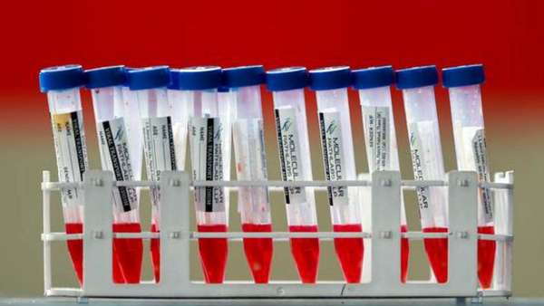  66 பேருக்கு கொரோனா