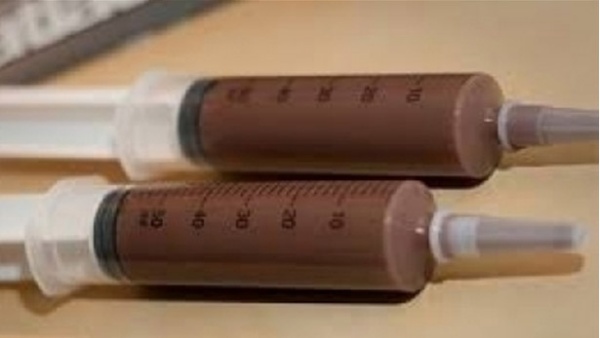 ஊசி சாக்லேட்