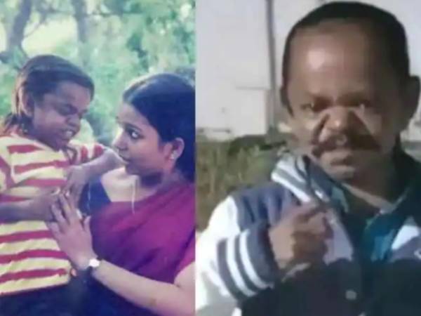  மாரடைப்பு