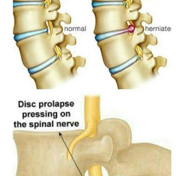 இடுப்பு எலும்பு 