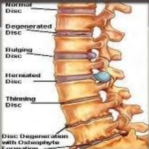முதுகுதண்டுவடம் 