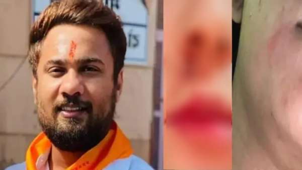  டிரஸ் இல்லை