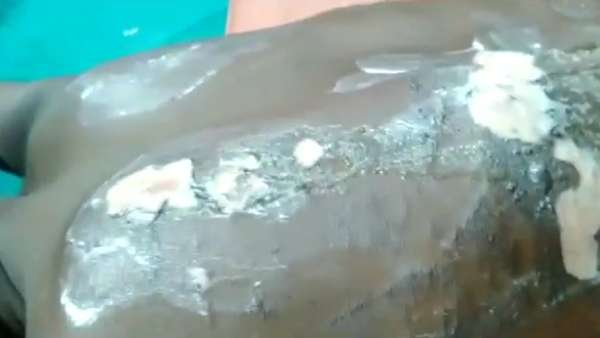 நெருப்பு