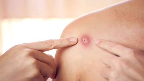 காரணம் என்ன? 