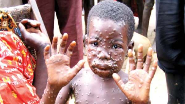 சதமடித்த பாதிப்பு 