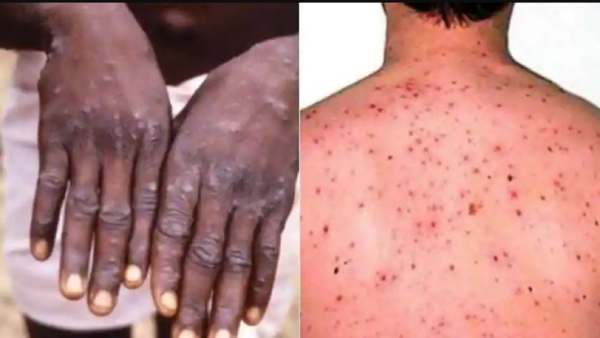 பயப்பட தேவையில்லை 