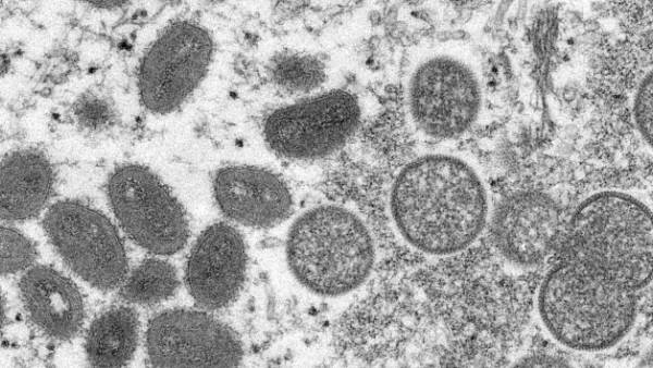  மிக மோசம்