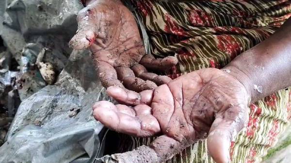 மகனுக்கு உடல்நிலை சரியில்லை 