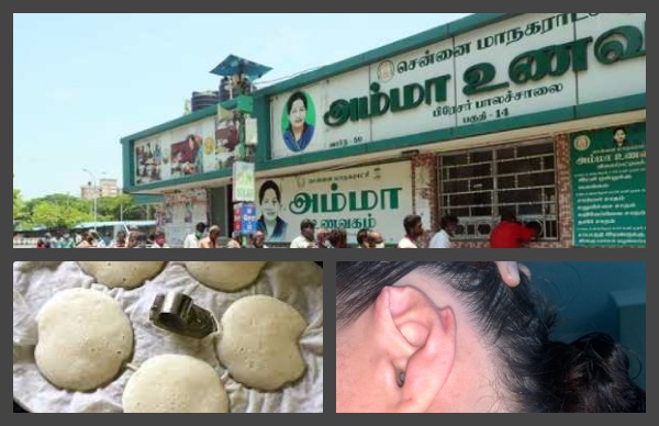 A female employees ear was bitten by a supervisor in a clash between staff at Amma unavagam A female employees ear was bitten by a supervisor in a clash between staff at Amma unavagam