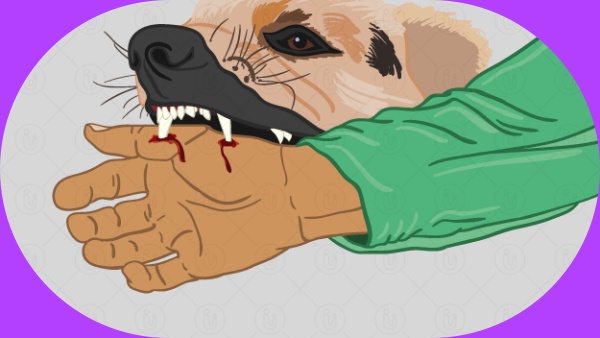 ரேபீஸ் தொற்று 