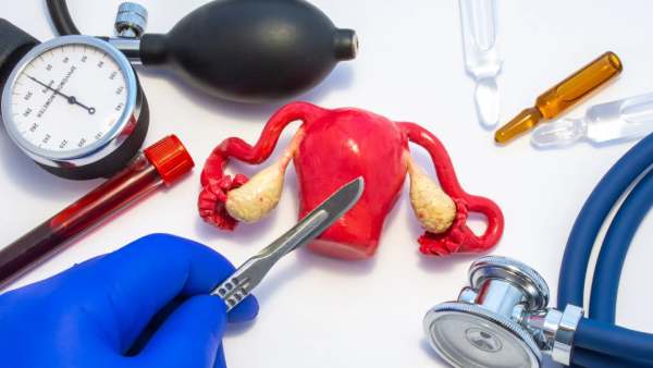 முக்கிய காரணம் முக்கிய காரணம்