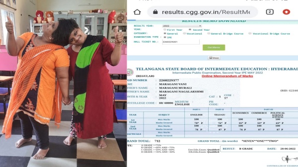 ஒட்டிய தலைகொண்ட இரட்டை சகோதரிகள் 