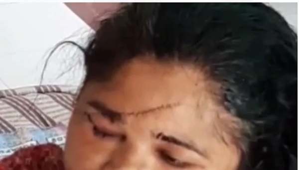 ரவுடிகளால் நேர்ந்த கொடூரம் ரவுடிகளால் நேர்ந்த கொடூரம்