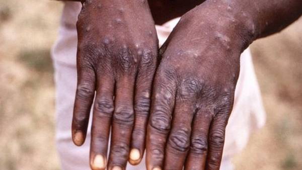  புது வேக்சின்