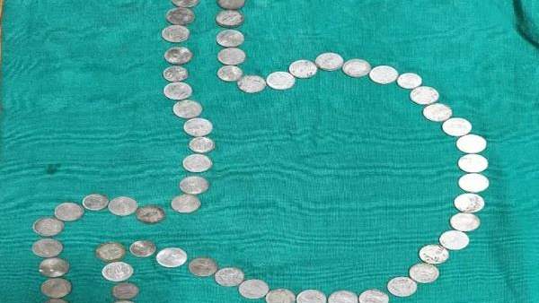 நாணயங்களை விழுங்கிய இளைஞர் நாணயங்களை விழுங்கிய இளைஞர்