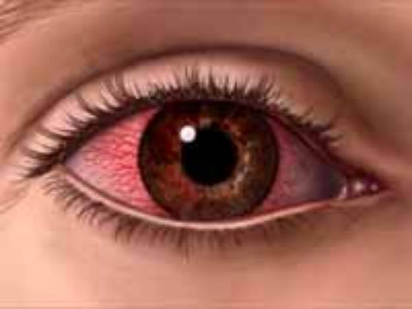 மெட்ரால் ஐ மெட்ரால் ஐ