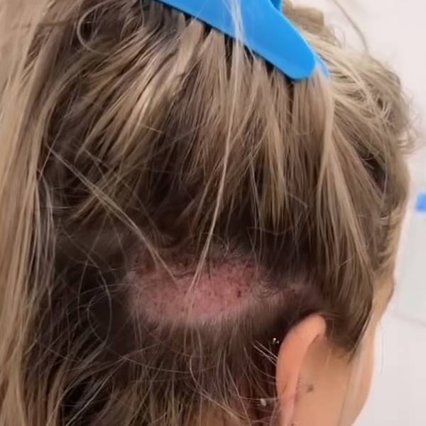 புதிய சிகிச்சை புதிய சிகிச்சை