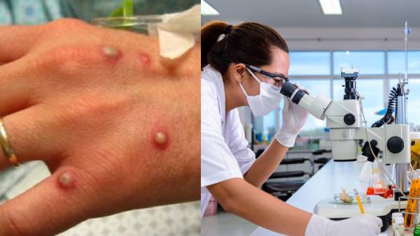  எப்படிப் பரவும்