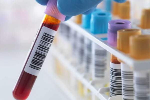  அறுவை சிகிச்சை