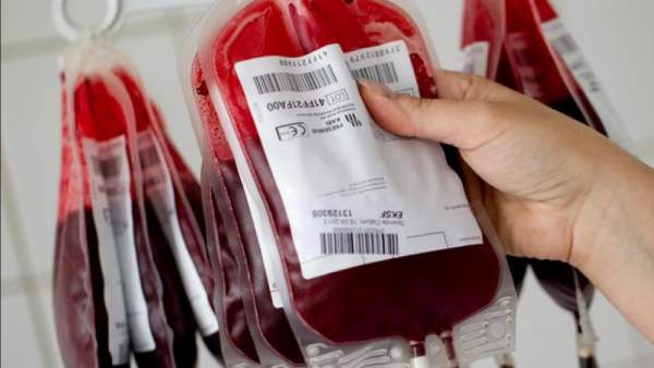  அரிய வகை