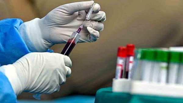  EMM நெகடிவ்