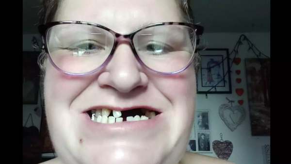 14 பற்கள் 