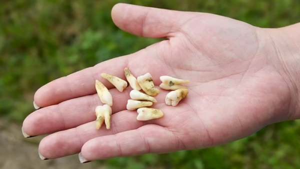  வலி நிவாரணி எடுத்துக் கொள்வேன் 