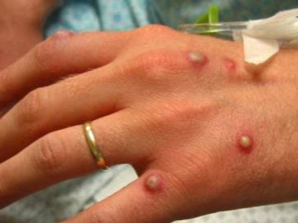 பிறப்பு உறுப்பு பிறப்பு உறுப்பு