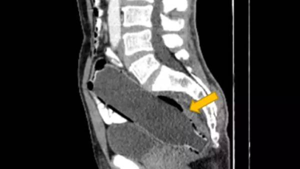 மருத்துவக் கண்காணிப்பு