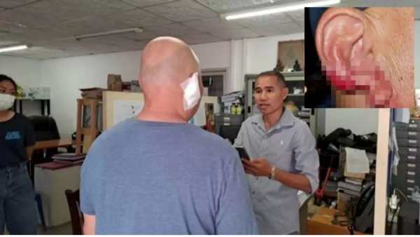 காதை கடித்த பெண் காதை கடித்த பெண்